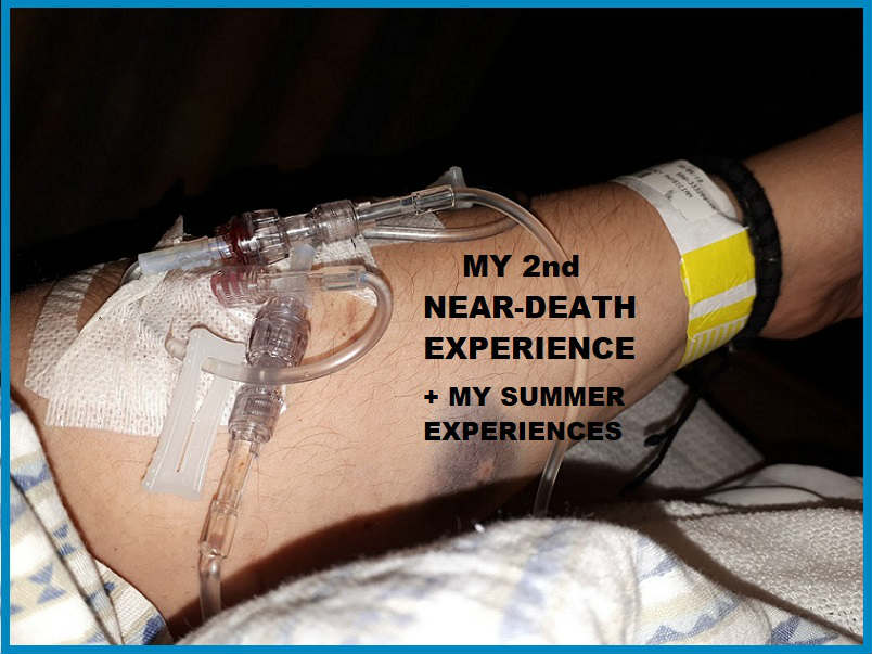 Me with two IV tubes in my arm when I was in the Hospital - May 2018